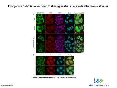 Endogenous SMN1 is not recruited to stress granules in HeLa cells after diverse stresses. Endogenous SMN1 is not recruited to stress granules in HeLa cells.