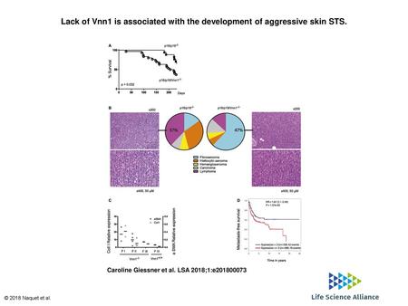 Lack of Vnn1 is associated with the development of aggressive skin STS