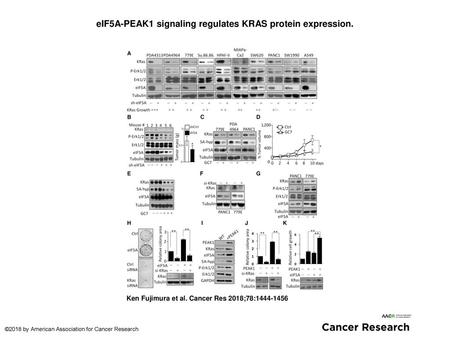 eIF5A-PEAK1 signaling regulates KRAS protein expression.