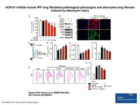 UCN‐01 inhibits human IPF lung fibroblast pathological phenotypes and attenuates lung fibrosis induced by bleomycin injury UCN‐01 inhibits human IPF lung.