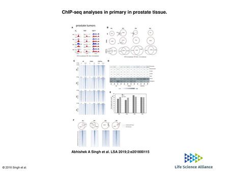 ChIP-seq analyses in primary in prostate tissue.