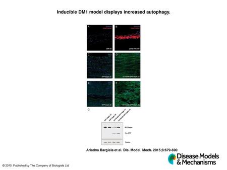 Inducible DM1 model displays increased autophagy.