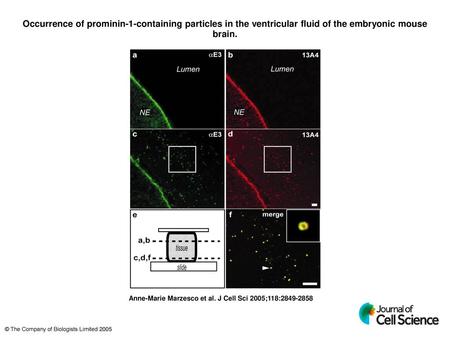 Occurrence of prominin-1-containing particles in the ventricular fluid of the embryonic mouse brain. Occurrence of prominin-1-containing particles in the.