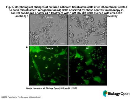 Fig. 2. Morphological changes of cultured adherent fibroblastic cells after OA treatment related to actin microfilament reorganization.(A) Cells observed.