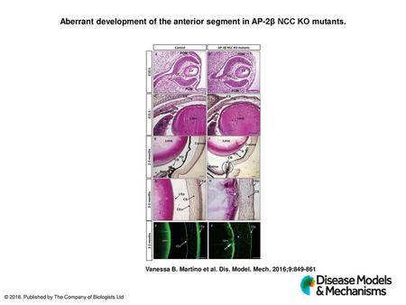 Aberrant development of the anterior segment in AP-2β NCC KO mutants.