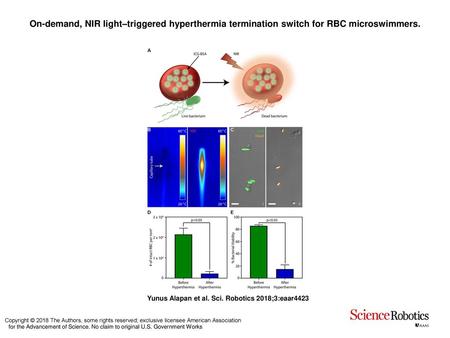 On-demand, NIR light–triggered hyperthermia termination switch for RBC microswimmers. On-demand, NIR light–triggered hyperthermia termination switch for.