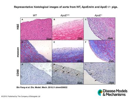 Representative histological images of aorta from WT, ApoEm/m and ApoE−/− pigs. Representative histological images of aorta from WT, ApoEm/m and ApoE−/−