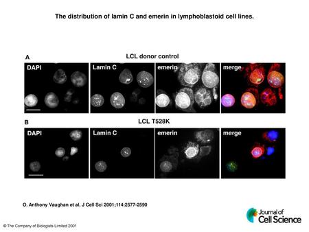 The distribution of lamin C and emerin in lymphoblastoid cell lines.