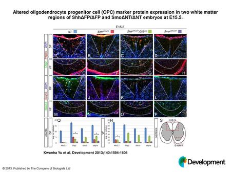 Altered oligodendrocyte progenitor cell (OPC) marker protein expression in two white matter regions of ShhΔFP/ΔFP and SmoΔNT/ΔNT embryos at E15.5. Altered.