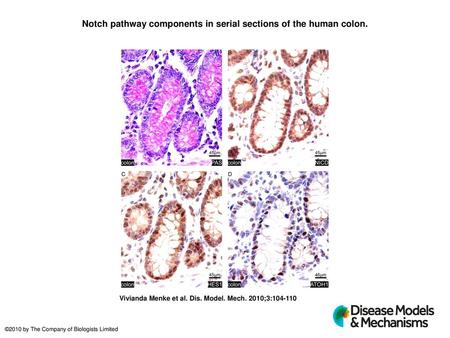 Notch pathway components in serial sections of the human colon.
