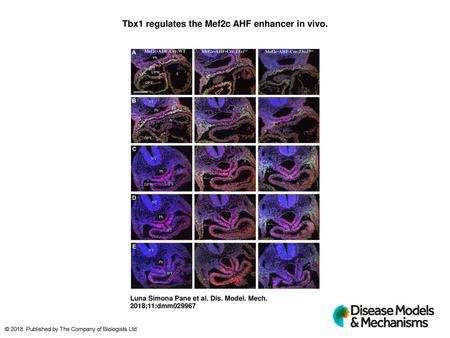 Tbx1 regulates the Mef2c AHF enhancer in vivo.