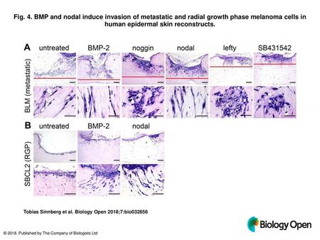 Fig. 4. BMP and nodal induce invasion of metastatic and radial growth phase melanoma cells in human epidermal skin reconstructs. BMP and nodal induce invasion.