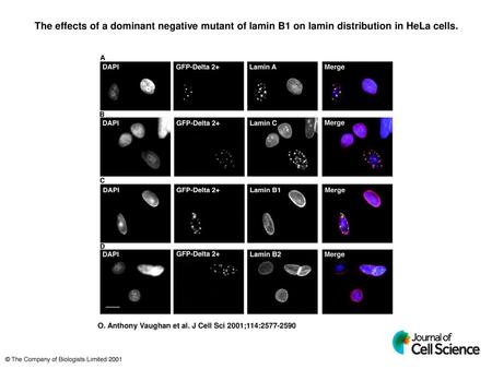 The effects of a dominant negative mutant of lamin B1 on lamin distribution in HeLa cells. The effects of a dominant negative mutant of lamin B1 on lamin.
