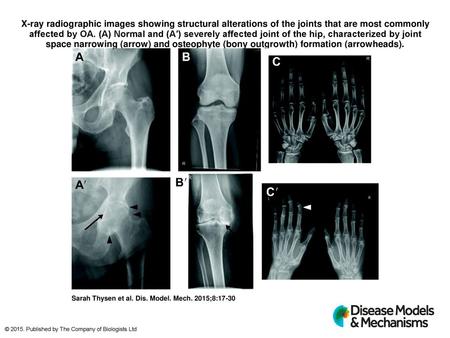 X-ray radiographic images showing structural alterations of the joints that are most commonly affected by OA. (A) Normal and (A′) severely affected joint.