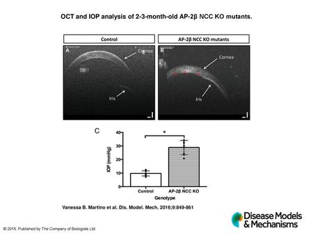 OCT and IOP analysis of 2-3-month-old AP-2β NCC KO mutants.