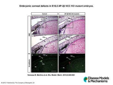 Embryonic corneal defects in E18.5 AP-2β NCC KO mutant embryos.