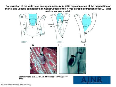 Construction of the wide neck aneurysm model