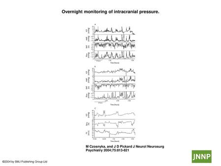 Overnight monitoring of intracranial pressure.
