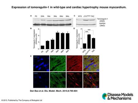 Expression of tomoregulin-1 in wild-type and cardiac hypertrophy mouse myocardium. Expression of tomoregulin-1 in wild-type and cardiac hypertrophy mouse.