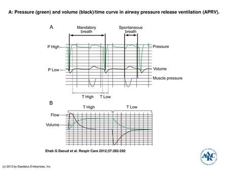 A: Pressure (green) and volume (black)/time curve in airway pressure release ventilation (APRV). A: Pressure (green) and volume (black)/time curve in airway.