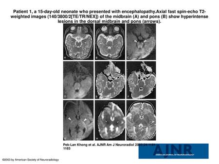 Patient 1, a 15-day-old neonate who presented with encephalopathy
