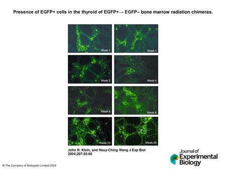 Presence of EGFP+ cells in the thyroid of EGFP+→ EGFP– bone marrow radiation chimeras. Presence of EGFP+ cells in the thyroid of EGFP+→ EGFP– bone marrow.
