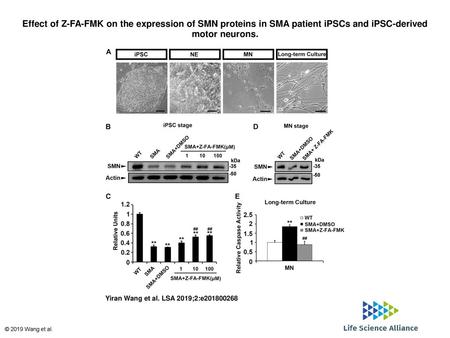 Effect of Z-FA-FMK on the expression of SMN proteins in SMA patient iPSCs and iPSC-derived motor neurons. Effect of Z-FA-FMK on the expression of SMN proteins.