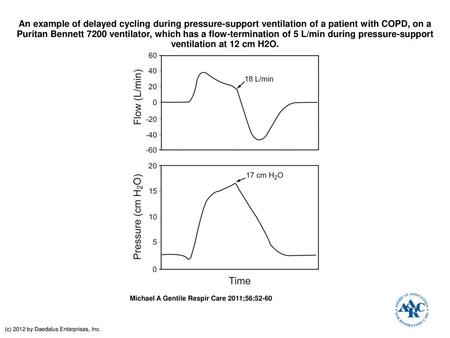 An example of delayed cycling during pressure-support ventilation of a patient with COPD, on a Puritan Bennett 7200 ventilator, which has a flow-termination.