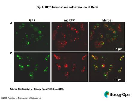 Fig. 5. GFP fluorescence colocalization of Gcn5.