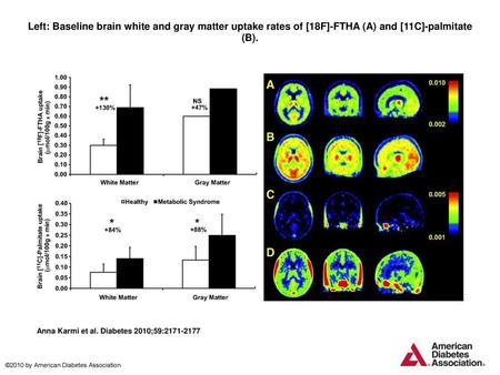 Left: Baseline brain white and gray matter uptake rates of [18F]-FTHA (A) and [11C]-palmitate (B). Left: Baseline brain white and gray matter uptake rates.