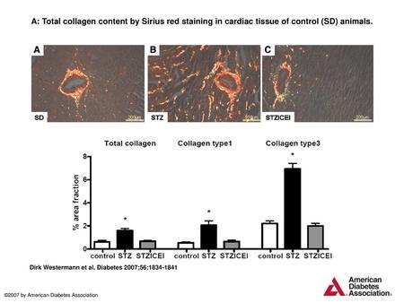 A: Total collagen content by Sirius red staining in cardiac tissue of control (SD) animals. A: Total collagen content by Sirius red staining in cardiac.