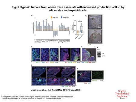 Fig. 5 Hypoxic tumors from obese mice associate with increased production of IL-6 by adipocytes and myeloid cells. Hypoxic tumors from obese mice associate.