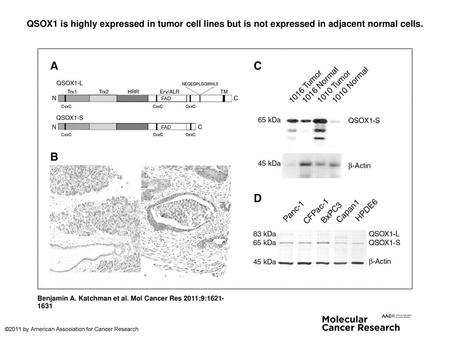 QSOX1 is highly expressed in tumor cell lines but is not expressed in adjacent normal cells. QSOX1 is highly expressed in tumor cell lines but is not expressed.