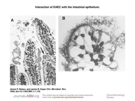 Interaction of EAEC with the intestinal epithelium.