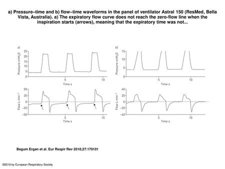 A) Pressure–time and b) flow–time waveforms in the panel of ventilator Astral 150 (ResMed, Bella Vista, Australia). a) The expiratory flow curve does not.
