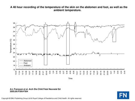  A 48 hour recording of the temperature of the skin on the abdomen and foot, as well as the ambient temperature.  A 48 hour recording of the temperature.