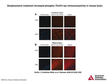 Streptozotocin treatment increased phospho–Thr231-tau immunoreactivity in mouse brain. Streptozotocin treatment increased phospho–Thr231-tau immunoreactivity.