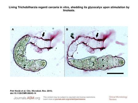 Living Trichobilharzia regenti cercaria in vitro, shedding its glycocalyx upon stimulation by linoleate. Living Trichobilharzia regenti cercaria in vitro,
