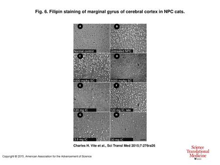 Filipin staining of marginal gyrus of cerebral cortex in NPC cats