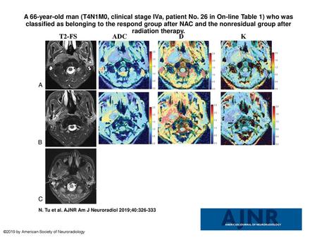 A 66-year-old man (T4N1M0, clinical stage IVa, patient No