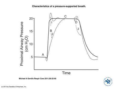 Characteristics of a pressure-supported breath.