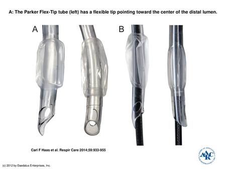 A: The Parker Flex-Tip tube (left) has a flexible tip pointing toward the center of the distal lumen. A: The Parker Flex-Tip tube (left) has a flexible.