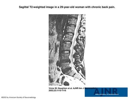 Sagittal T2-weighted image in a 29-year-old woman with chronic back pain. Sagittal T2-weighted image in a 29-year-old woman with chronic back pain. Intervertebral.