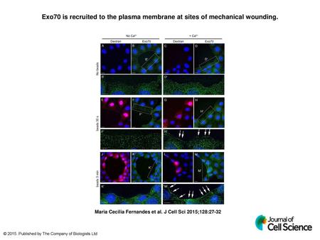 Exo70 is recruited to the plasma membrane at sites of mechanical wounding. Exo70 is recruited to the plasma membrane at sites of mechanical wounding. NRK.