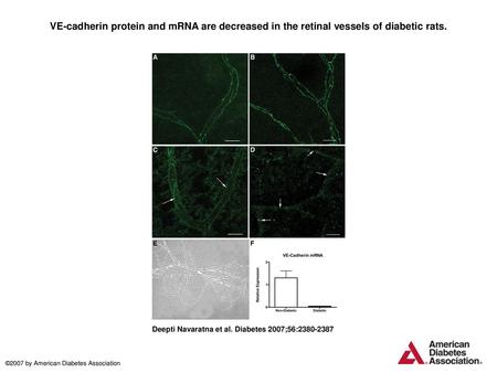 VE-cadherin protein and mRNA are decreased in the retinal vessels of diabetic rats. VE-cadherin protein and mRNA are decreased in the retinal vessels of.