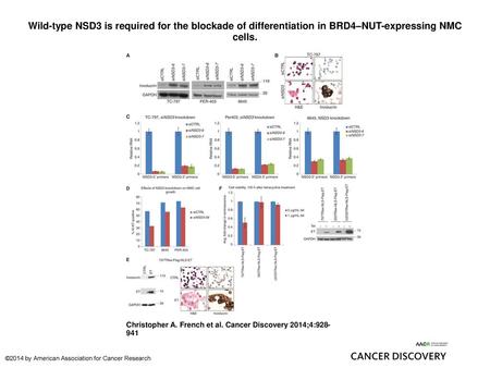 Wild-type NSD3 is required for the blockade of differentiation in BRD4–NUT-expressing NMC cells. Wild-type NSD3 is required for the blockade of differentiation.
