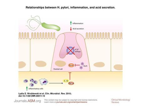 Relationships between H. pylori, inflammation, and acid secretion.