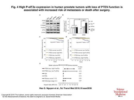Fig. 4 High P-eIF2α expression in human prostate tumors with loss of PTEN function is associated with increased risk of metastasis or death after surgery.