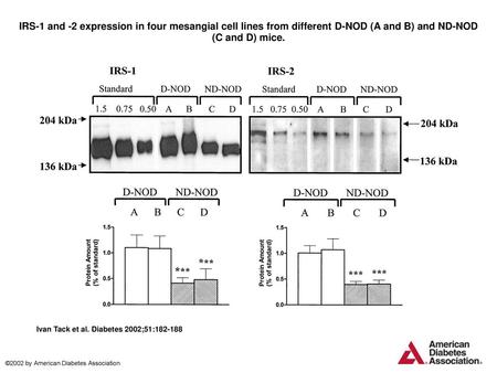 IRS-1 and -2 expression in four mesangial cell lines from different D-NOD (A and B) and ND-NOD (C and D) mice. IRS-1 and -2 expression in four mesangial.