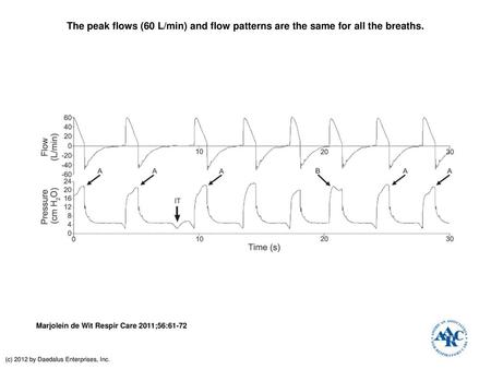 The peak flows (60 L/min) and flow patterns are the same for all the breaths. The peak flows (60 L/min) and flow patterns are the same for all the breaths.